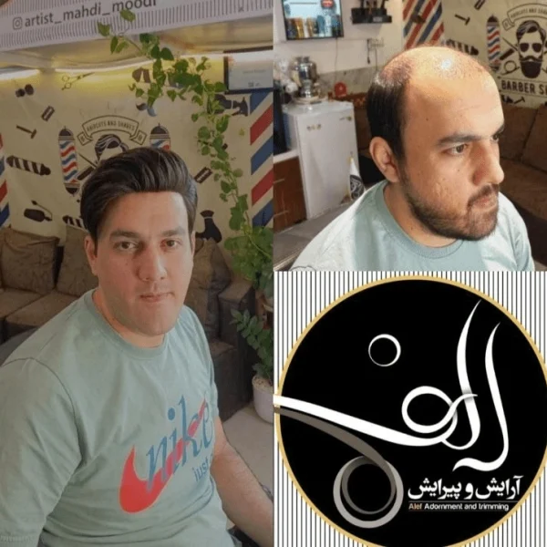 پروتز مو - آرایش و پیرایش الف بیرجند