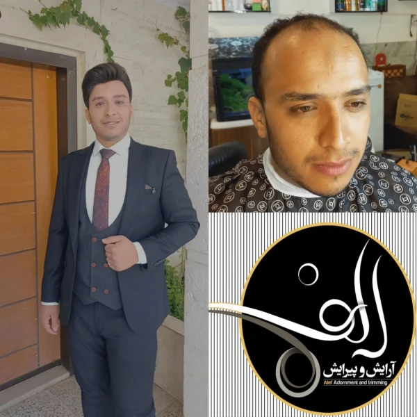 پروتز مو - آرایش و پیرایش الف بیرجند