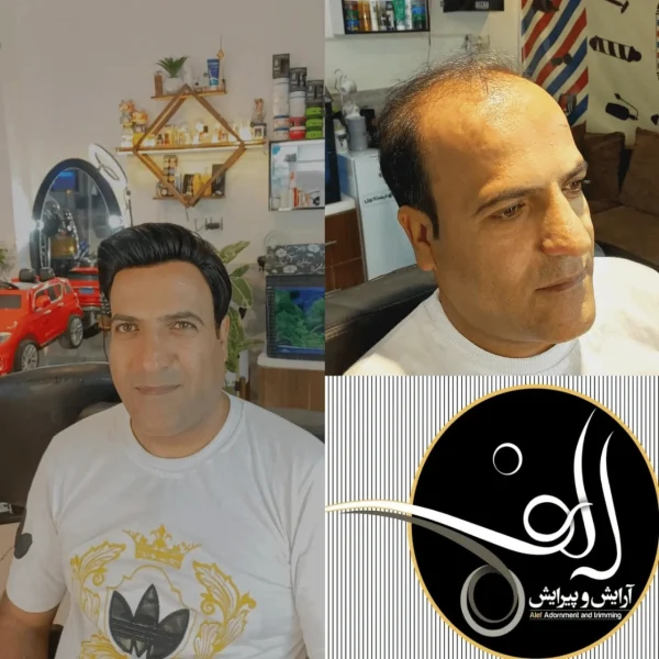 پروتز مو - آرایش و پیرایش الف بیرجند