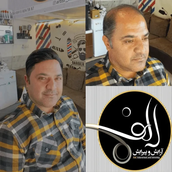 پروتز مو - آرایش و پیرایش الف بیرجند