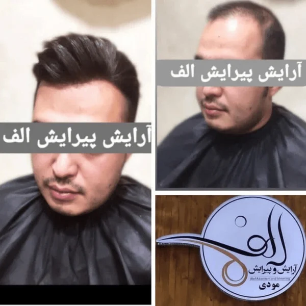 پروتز مو - آرایش و پیرایش الف بیرجند