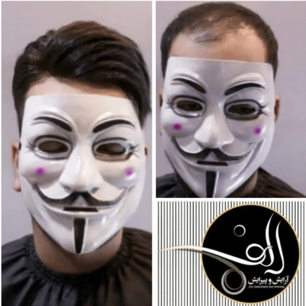 پروتز مو - آرایش و پیرایش الف بیرجند