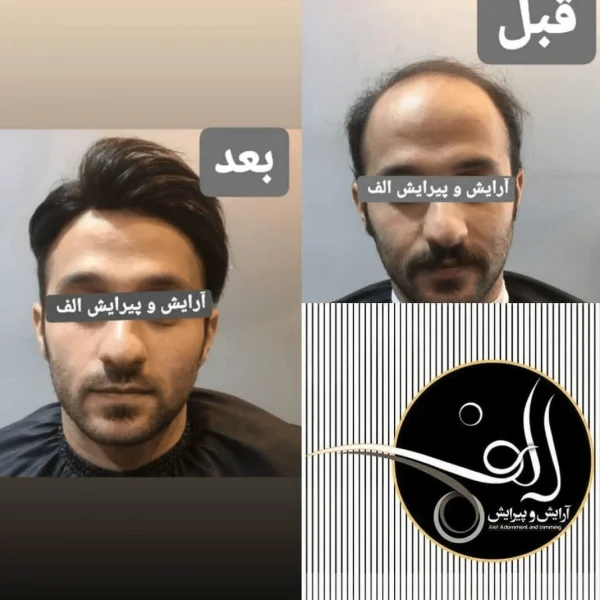 پروتز مو - آرایش و پیرایش الف بیرجند