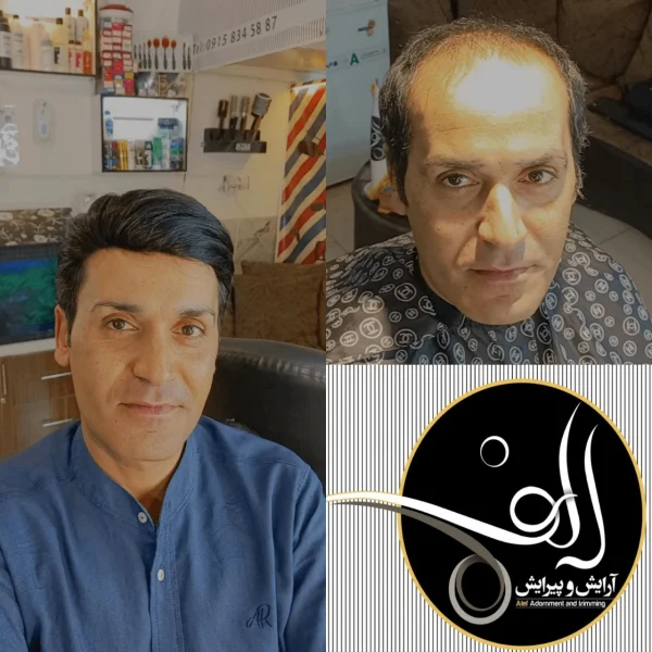 پروتز مو - آرایش و پیرایش الف بیرجند